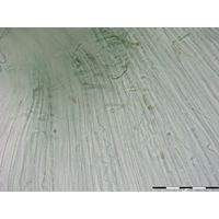 Nostochopsis lobatus