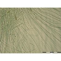 Nostochopsis lobatus
