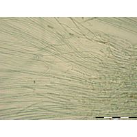 Nostochopsis lobatus