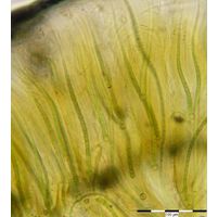 Rivularia mesenterica