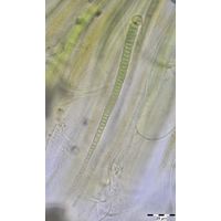 Rivularia mesenterica