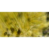 Rivularia mesenterica