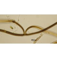 Scytonema cf. myochrous