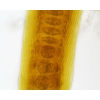 Scytonema
