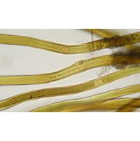 Scytonema sp.