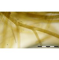 Tolypothrix distorta