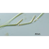 Tolypothrix distorta 