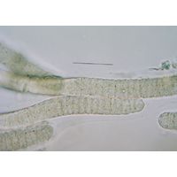 Blennothrix