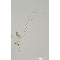 Glaucospira laxissima