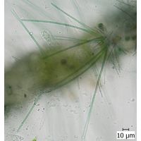 Heteroleibleinia