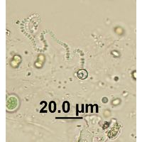 Komvophoron sp.
