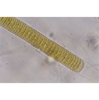 Lyngbya aestuarii