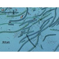 Phormidium nigroviridis