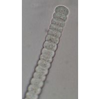Planktothrix planctonica