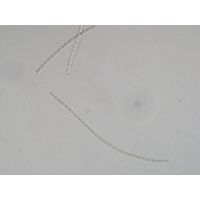 Pseudanabaena sp.
