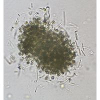 Pseudanabaena mucicola