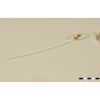 Pseudanabaena