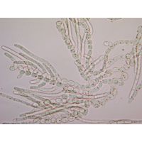 Nostochopsis