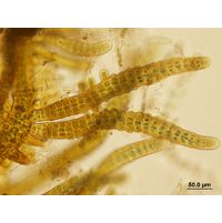 Stigonema mamillosum