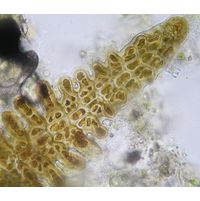 Stigonema mamillosum