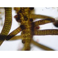 Stigonema mamillosum