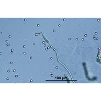 Westiellopsis prolifica