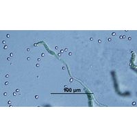 Westiellopsis prolifica