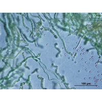 Westiellopsis prolifica