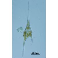 Ceratium furcoides