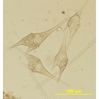 Ceratium furcoides