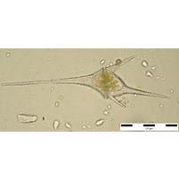 Ceratium hirundinella