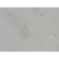 Ceratium tripos