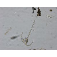 Ceratium tripos