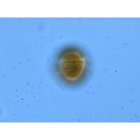 Gymnodinium sp.