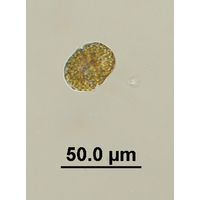 Gyrodinium sp. 