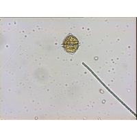 Naiadinium polonicum 