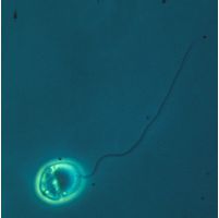 Noctiluca miliaris
