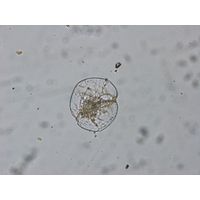 Noctiluca scintilans