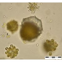Parvodinium cf. umbonatum 
