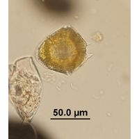 Peridinium bipes