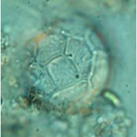 Peridinium pseudolaeve