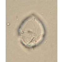 Peridinium umbonatum