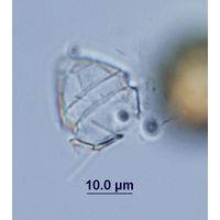 Peridinium umobonatum