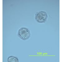 Peridinium willei