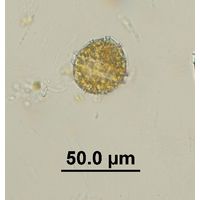 Peridinium sp. 