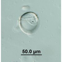 Phalacroma cf. rotundatum