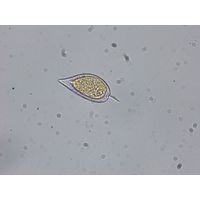 Prorocentrum micans