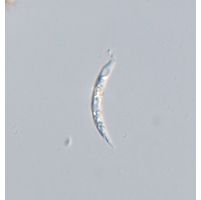 Astasia curvata
