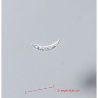 Astasia curvata