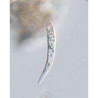 Astasia curvata